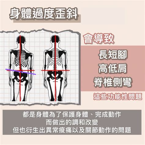 身體歪斜